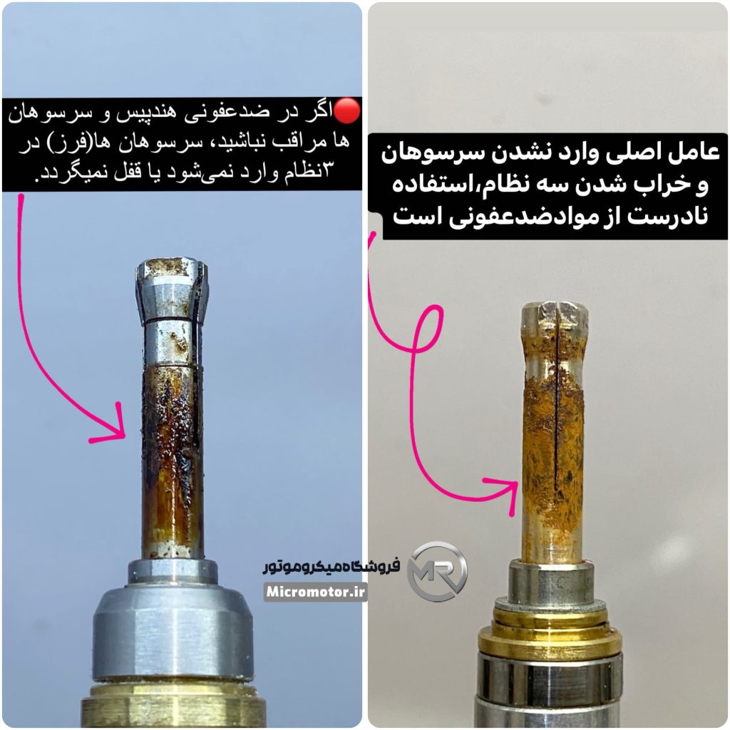 همه چیز در مورد سه نظام میکروموتور